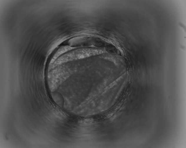 X0000091720196200709211007