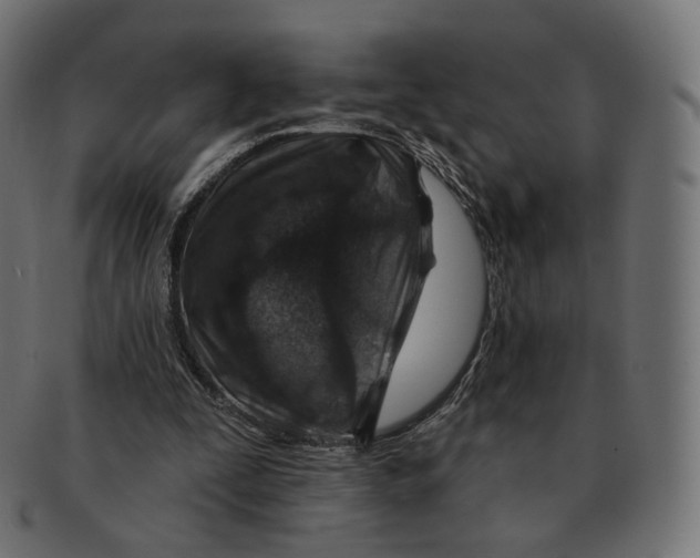 X0000091720295200709211006