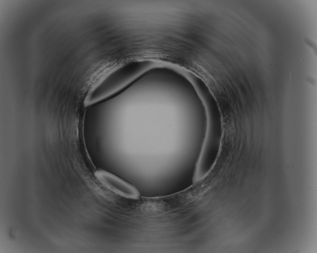 X0000091720350200709211005