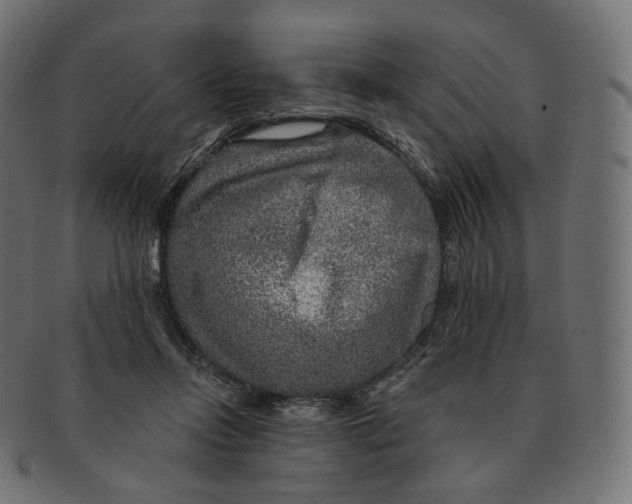 X0000091720358200709211005