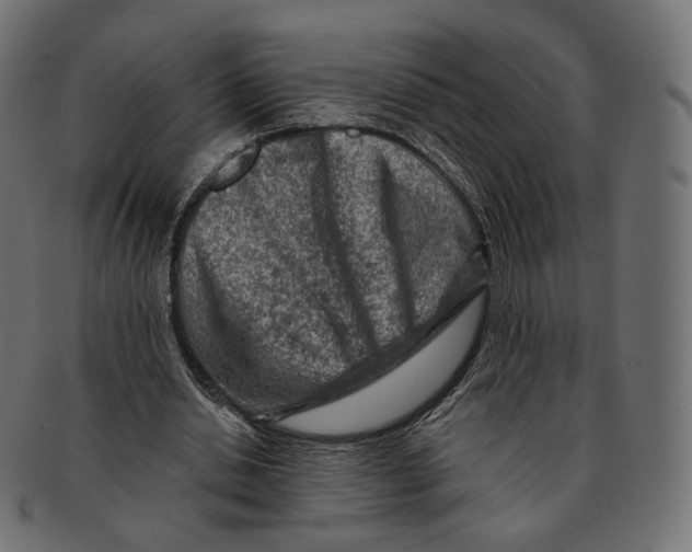 X0000091720438200709211004