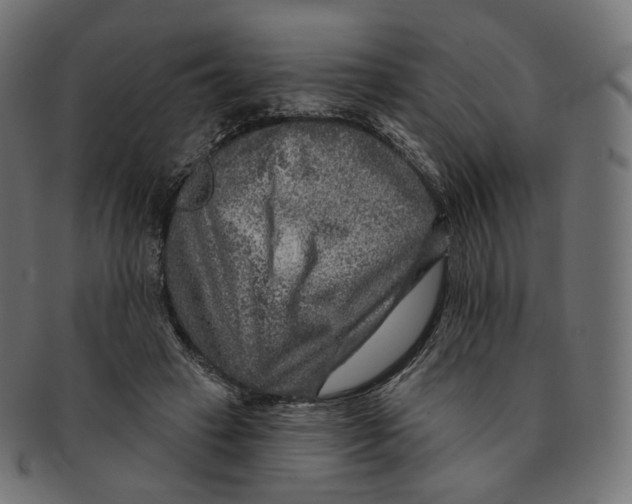 X0000091720449200709211004