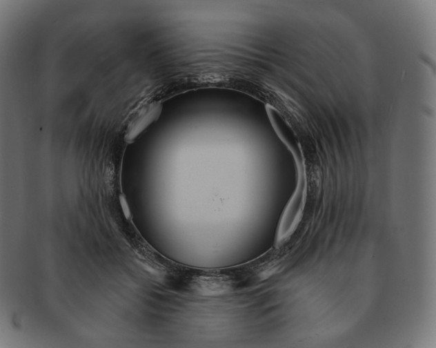 X0000091720556200709211003