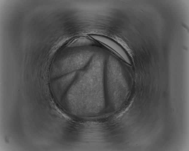 X0000091720577200709211003