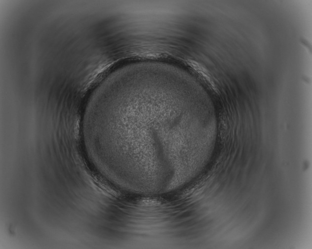 X0000091720596200709211002