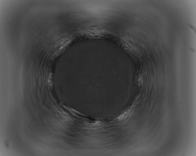 X0000091731156200709211014