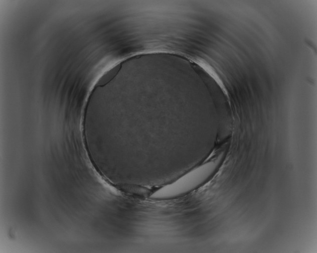 X0000091851197200709191050