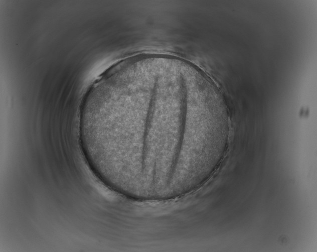 X0000091850005200710031651