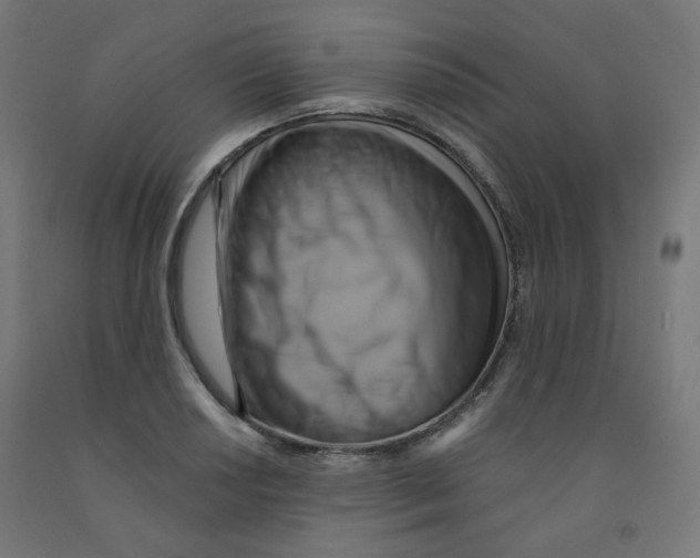 X0000091851034200710031637