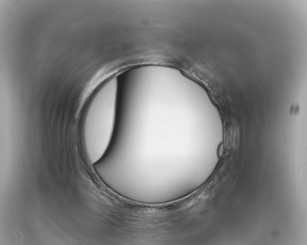 X0000091860198200709051004