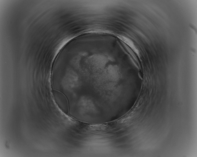 X0000091860863200709191115