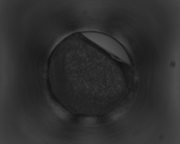 X0000091860156200710031047