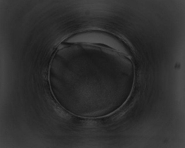 X0000091860785200710031039