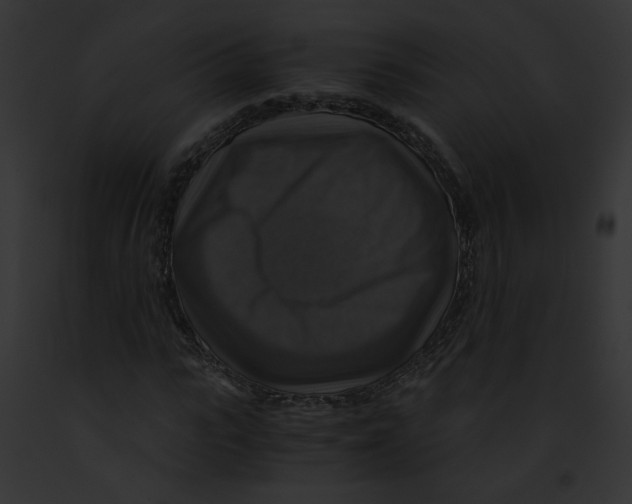 X0000091860919200710031037