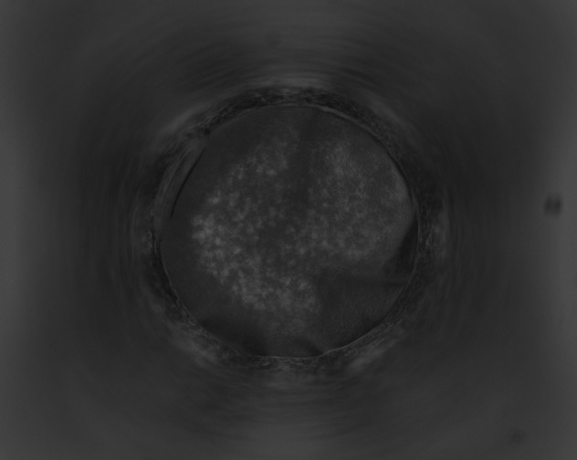 X0000091861014200710031036