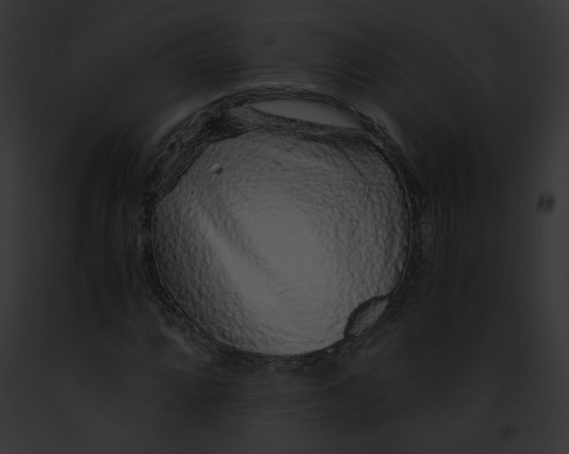 X0000091861064200710031035