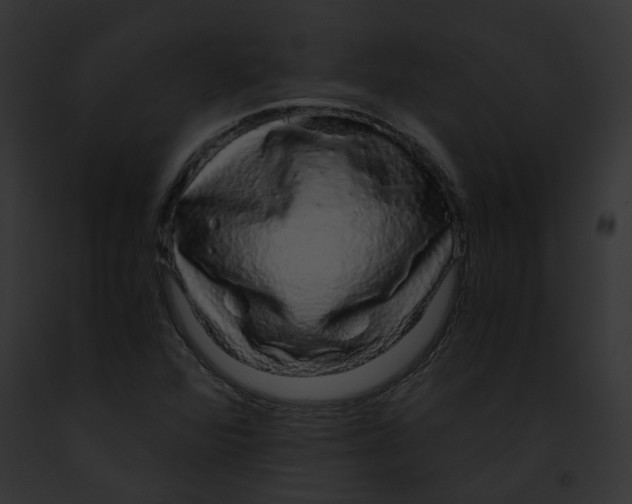 X0000091861360200710031032