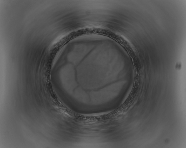 X0000091860919200710031658