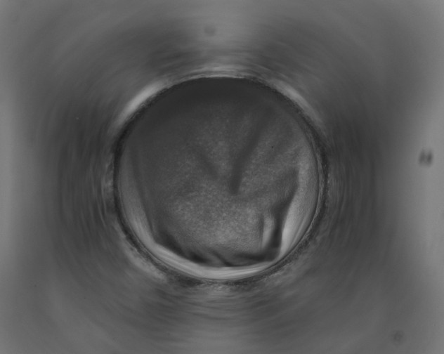 X0000091861450200710031652