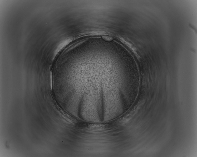 X0000091881171200709191150