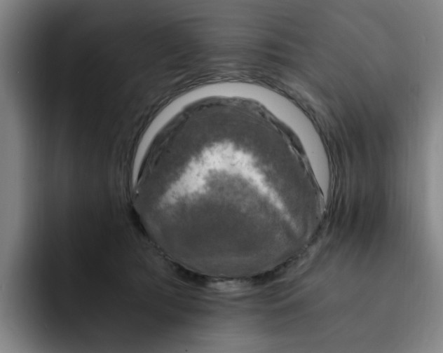 X0000091900417200709261701