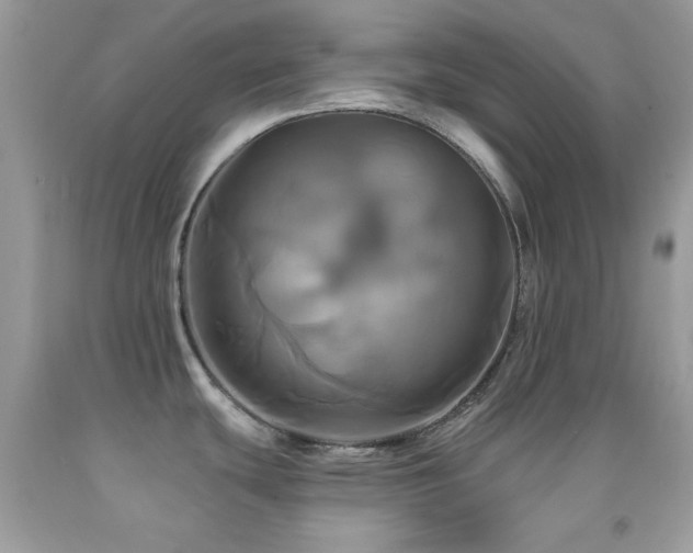 X0000091911439200709051409