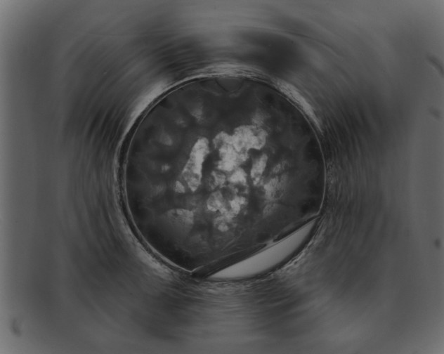 X0000091911091200709191315