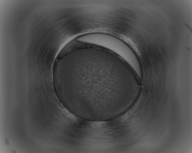 X0000091911184200709191314