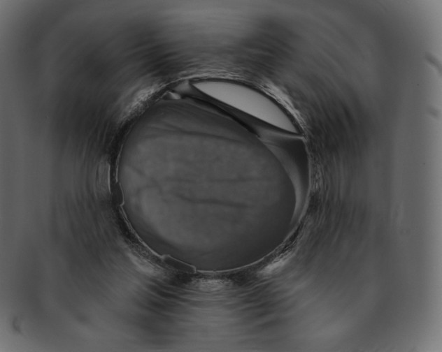 X0000091910205200710031025