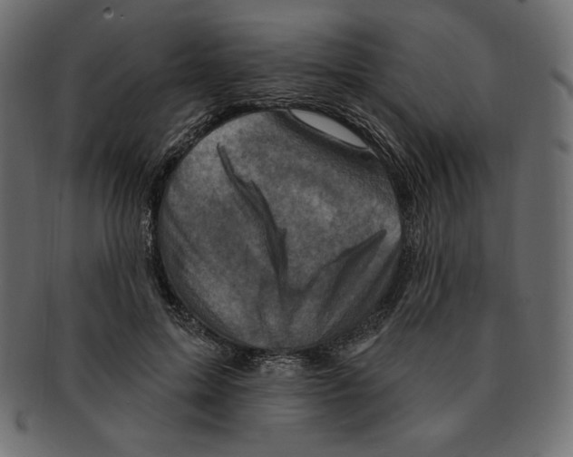 X0000091910599200710031020