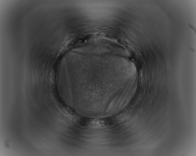 X0000091910760200710031019