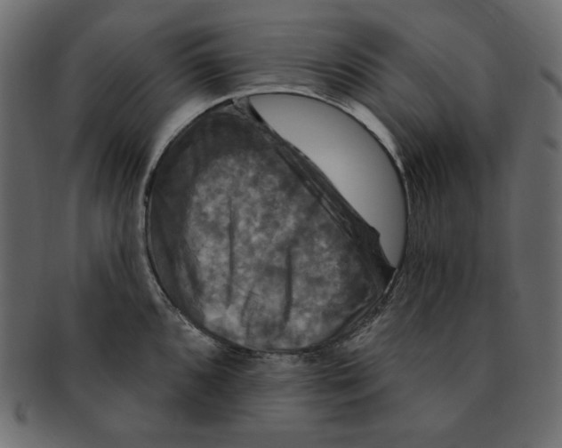 X0000091911096200710031014