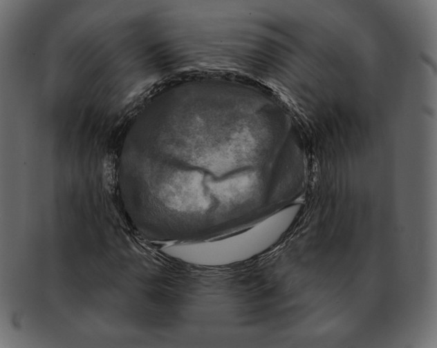 X0000091911110200710031014