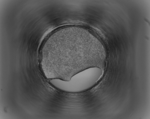 X0000091911172200710031013