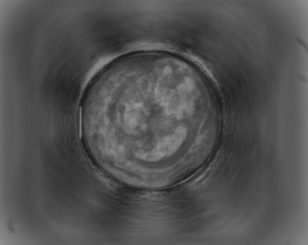 X0000091911175200710031013