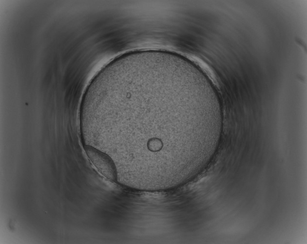 X0000091911191200710031013