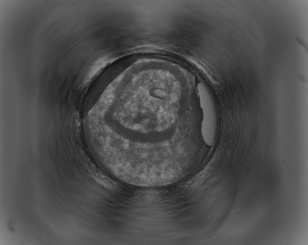 X0000091911355200710031011