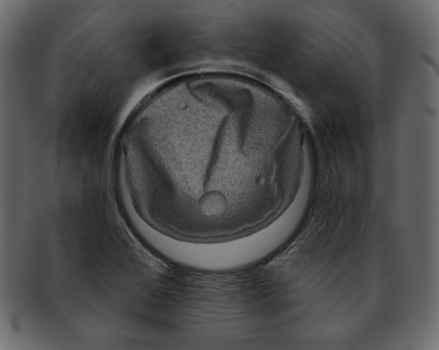 X0000091911368200710031011