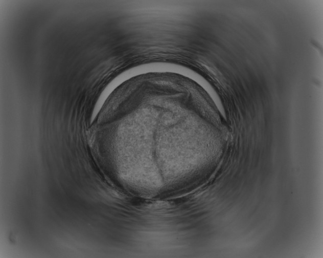 X0000091920125200710031047