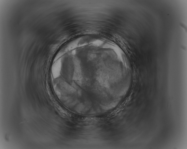 X0000091920145200710031046