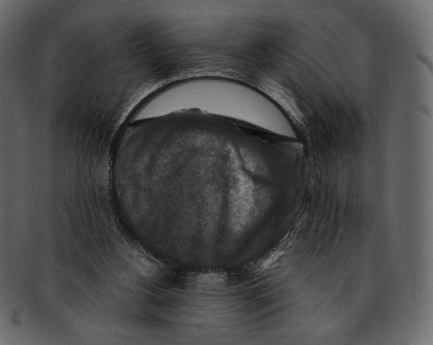 X0000091920156200710031046
