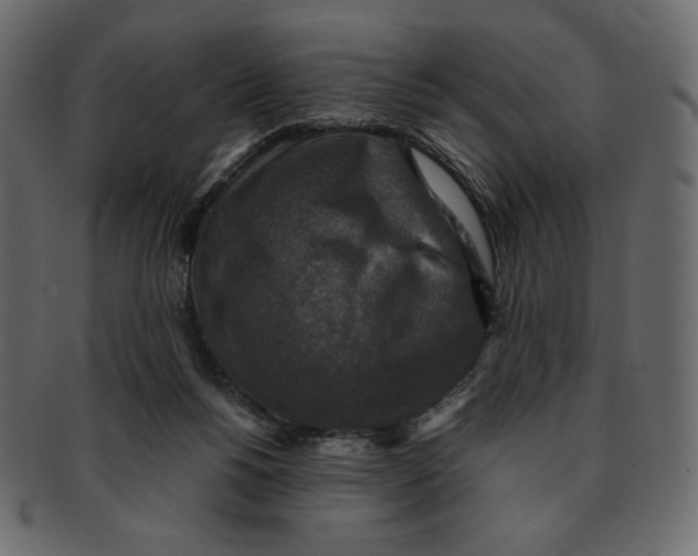 X0000091920168200710031046