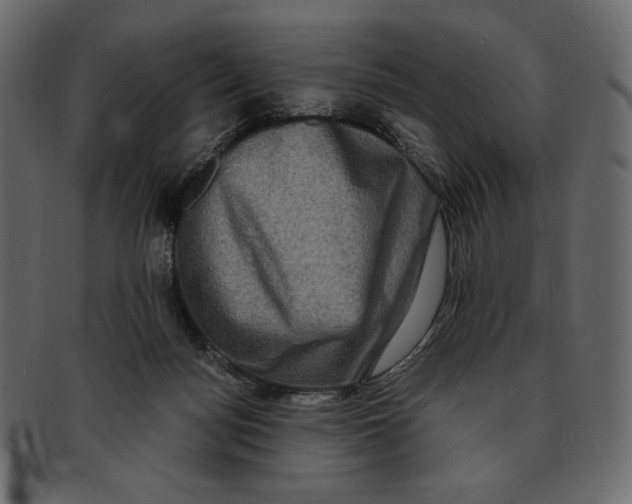 X0000091920172200710031047