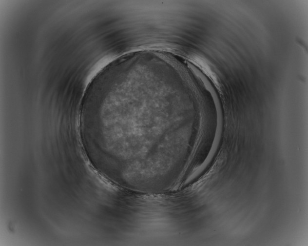 X0000091920952200710031036