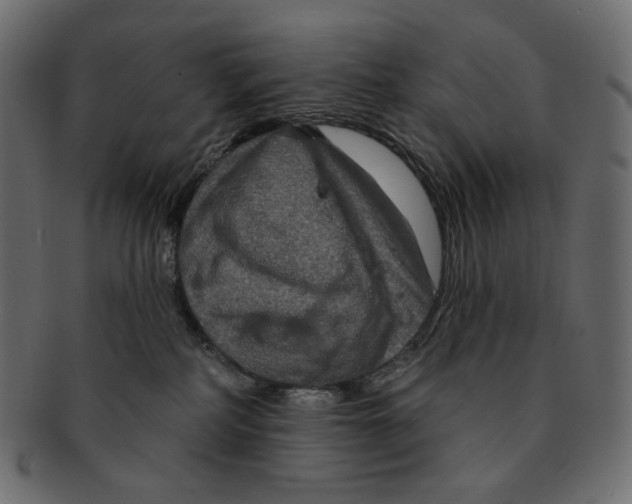 X0000091930234200710031105