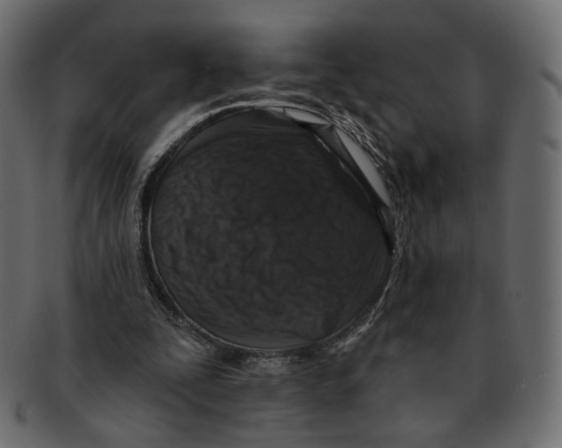 X0000091930295200710031104