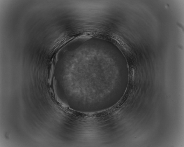 X0000091930696200710031059