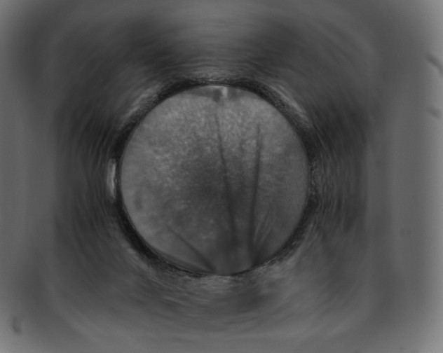 X0000091940024200710031126