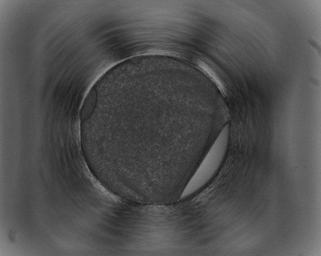 X0000091941092200710031113