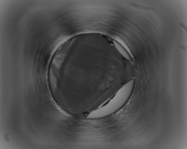 X0000091941197200710031112